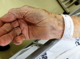 Outro novo sistema em implantação no Hospital São José é o de identificação de pacientes por meio de uma pulseira que contém impresso o nome completo, nome da mãe, data de nascimento, idade, sexo, número do prontuário e data de internação. - Fotografo: Divulgação Hospital São José - Data: 27/08/2012
